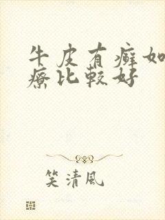 牛皮有癣如何治疗比较好