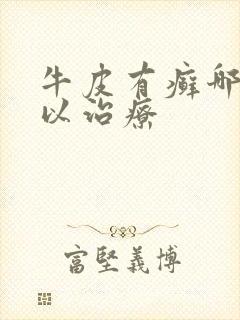 牛皮有癣哪里可以治疗