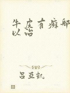 牛皮有癣哪里可以治