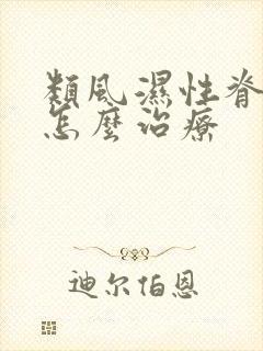 类风湿性脊柱炎怎么治疗