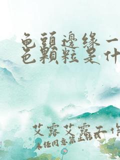 龟头边缘一圈白色颗粒是什么