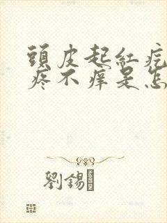 头皮起红疙瘩不疼不痒是怎么回事