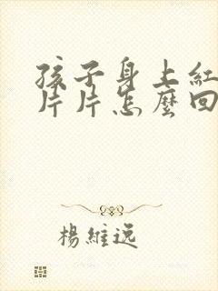 孩子身上红痒一片片怎么回事