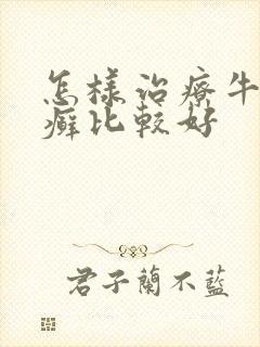 怎样治疗牛皮有癣比较好