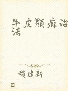 牛皮显癣治疗方法