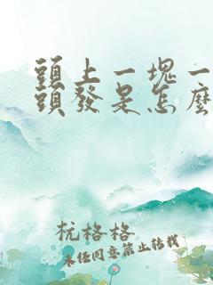 头上一块一块掉头发是怎么回事