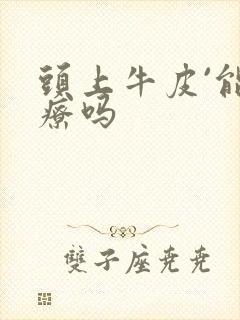 头上牛皮`能治疗吗