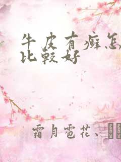 牛皮有癣怎么治比较好