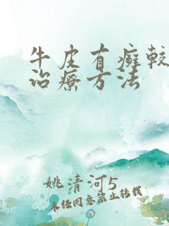 牛皮有癣较好的治疗方法