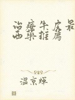 治疗牛皮最好的西药推荐