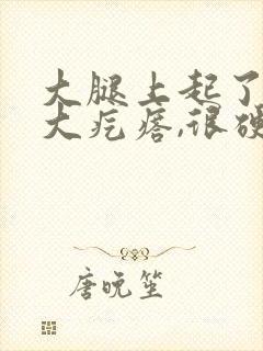 大腿上起了一个大疙瘩,很硬,一按疼