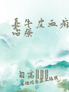 长牛皮血癣怎么治疗