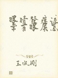 眼睛发痒流泪经常有眼屎怎么回事儿