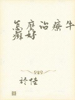 怎么治疗牛皮有癣好