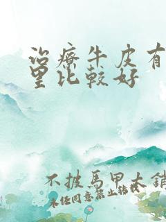 治疗牛皮有癣哪里比较好