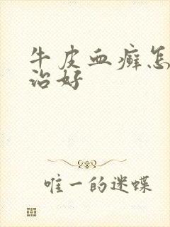 牛皮血癣怎么能治好