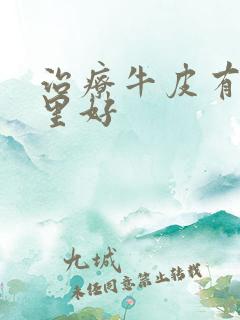 治疗牛皮有癣哪里好