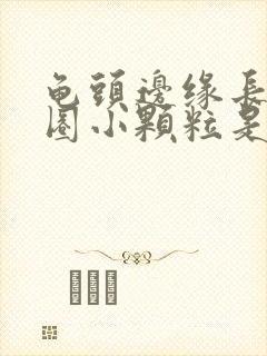 龟头边缘长了一圈小颗粒是什么原因