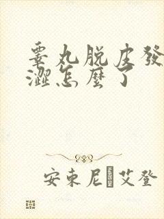 睾丸脱皮发痒干涩怎么了