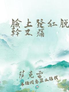 脸上发红脱皮又干又痛