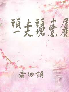 头上头皮屑一抠一大块怎么处理