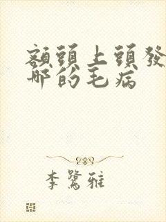 额头上头发白是哪的毛病