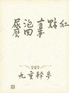 尿泡有点红色怎么回事