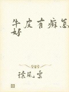 牛皮有癣怎么治好