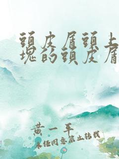 头皮屑头上有大块的头皮屑是怎么回事