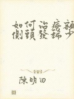 如何治疗额头两侧头发稀少