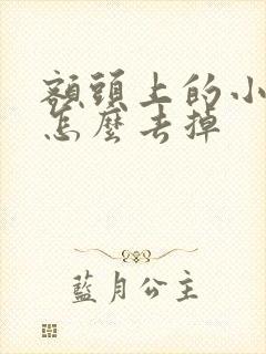 额头上的小头发怎么去掉