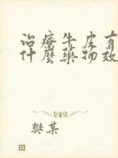 治疗牛皮有癣用什么药物效果好