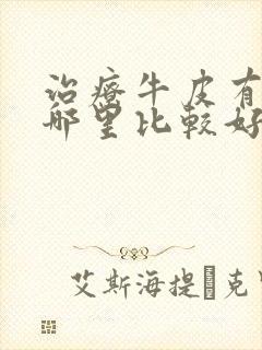 治疗牛皮有癣去哪里比较好