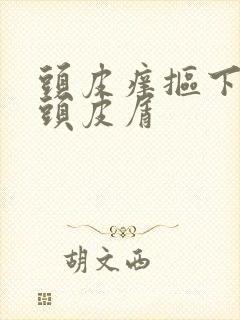 头皮痒抠下大块头皮屑