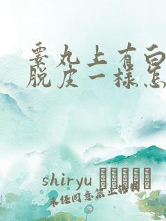 睾丸上有白色和脱皮一样怎么回事