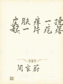 皮肤痒一挠就凸起一片疙瘩