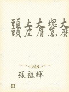 头上大块大块的头皮屑怎么回事