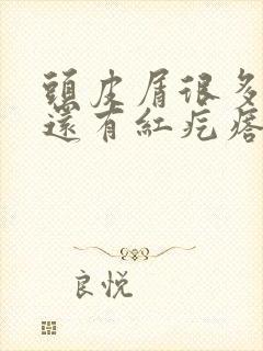 头皮屑很多头皮还有红疙瘩