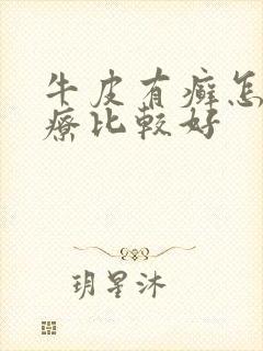 牛皮有癣怎么治疗比较好