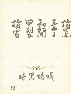 指甲和手指连接处裂开了怎么办