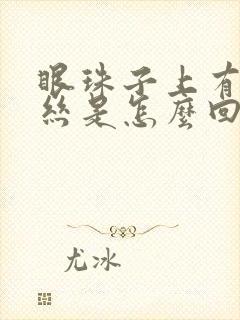 眼珠子上有红血丝是怎么回事