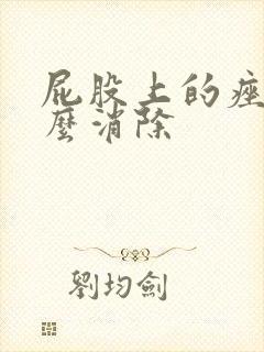 屁股上的痤疮怎么消除