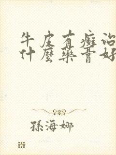 牛皮有癣治疗用什么药膏好