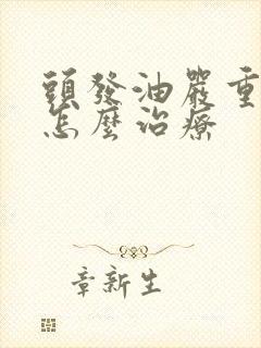 头发油严重脱发怎么治疗