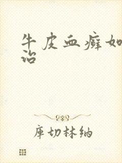 牛皮血癣如何医治