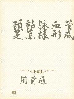 颈动脉血管斑块是怎样形成的