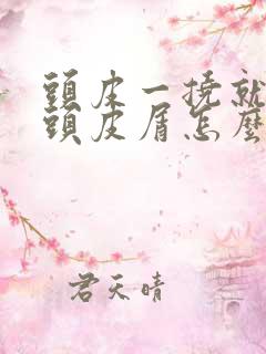 头皮一挠就很多头皮屑怎么办