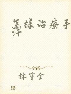 怎样治疗手心出汗