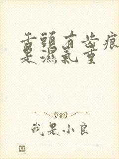 舌头有齿痕是不是湿气重