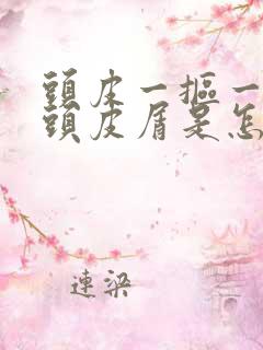 头皮一抠一大块头皮屑是怎么回事